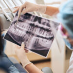 Are Dentist X-Rays Safe? Understanding What Happens at Your Check-Up