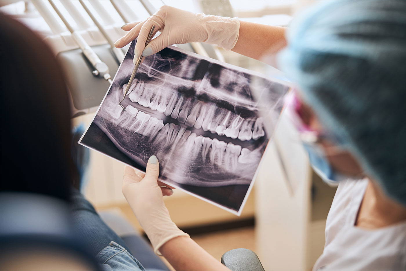 Are Dentist X-Rays Safe? Understanding What Happens at Your Check-Up